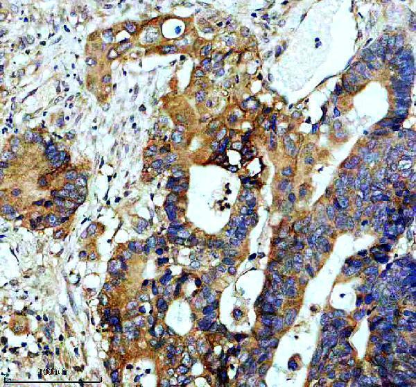 IHC analysis of SLC7A5 using anti-SLC7A5 antibody (M01016-2)