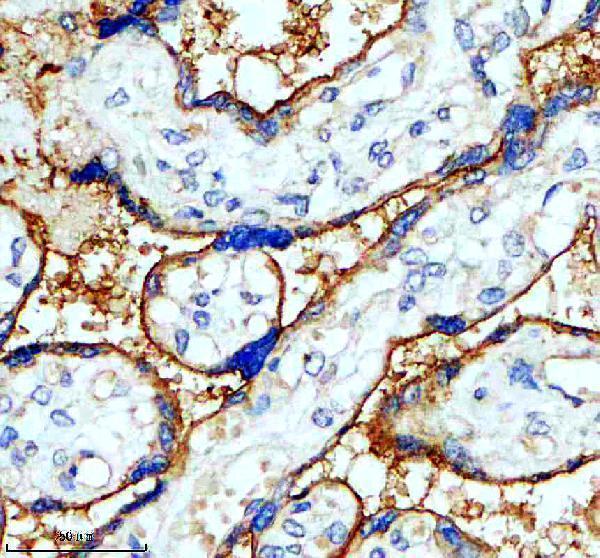 IHC analysis of SLC7A5 using anti-SLC7A5 antibody (M01016-2)