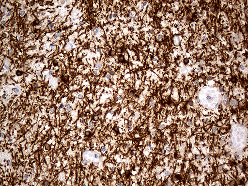 Immunohistochemical staining of paraffin-embedded Human embryonic cerebellum within the normal limits using anti-CNP mouse monoclonal antibody