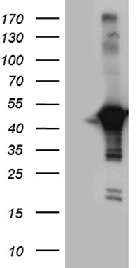 HEK293T cells were transfected with the pCMV6-ENTRY control (Left lane) or pCMV6-ENTRY CNP (Right lane) cDNA for 48 hrs and lysed