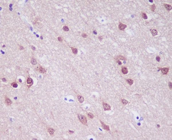 Immunohistochemical analysis of paraffin-embedded human brain, using PGP9