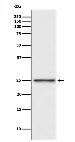 Western blot analysis of PGP9