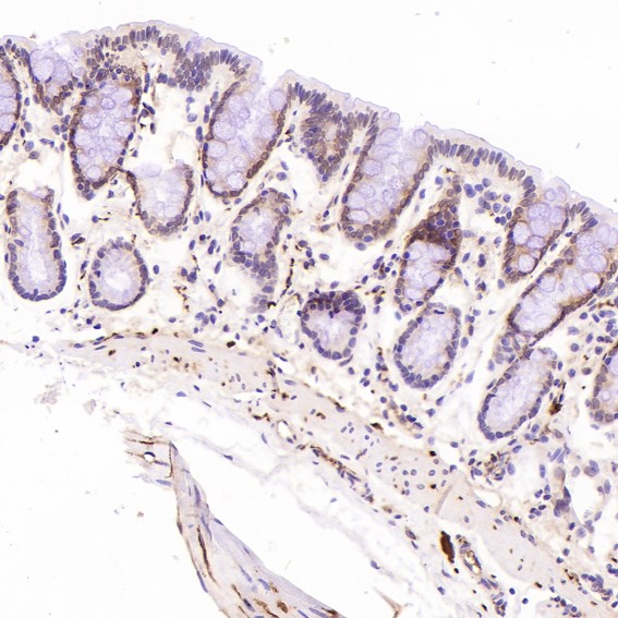 m01018 2 ihc7
