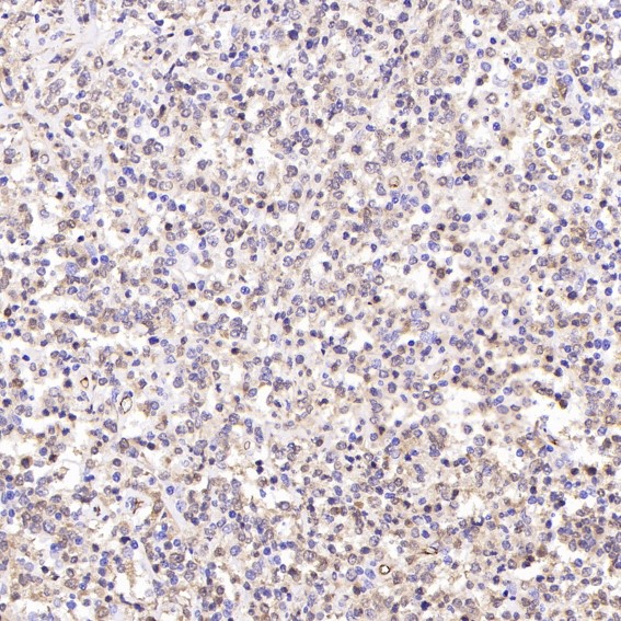 m01018 2 ihc8
