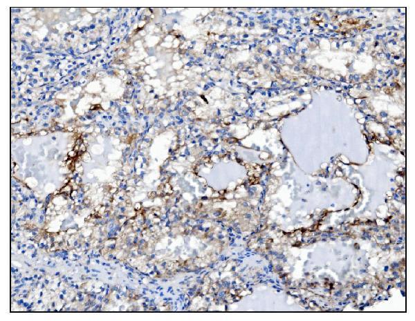m01018 6 pgp9 5 primary antibodies ihc testing 2