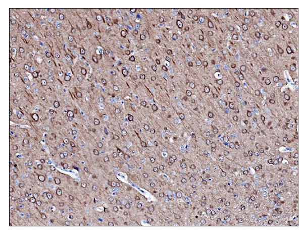 m01018 6 pgp9 5 primary antibodies ihc testing 3