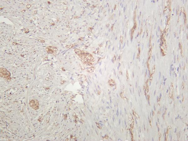 Human appendix was stained with anti-PGP9