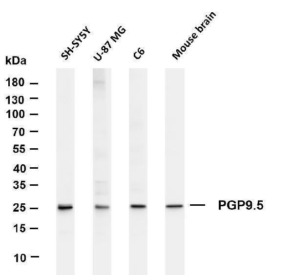 m01018 8 uchl1 primary antibodies wb testing 1