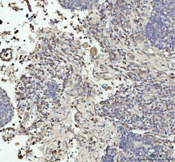  IHC analysis of GPX1 using anti-GPX1 antibody (M01019-1)