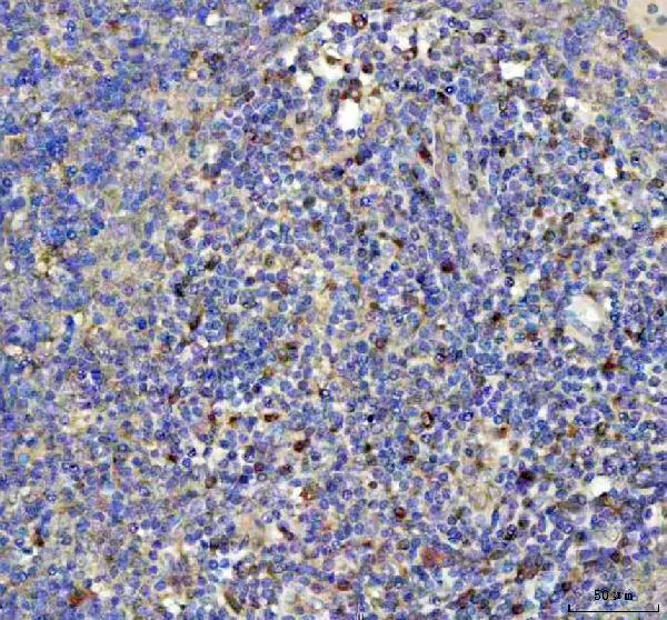  IHC analysis of GPX1 using anti-GPX1 antibody (M01019-1)