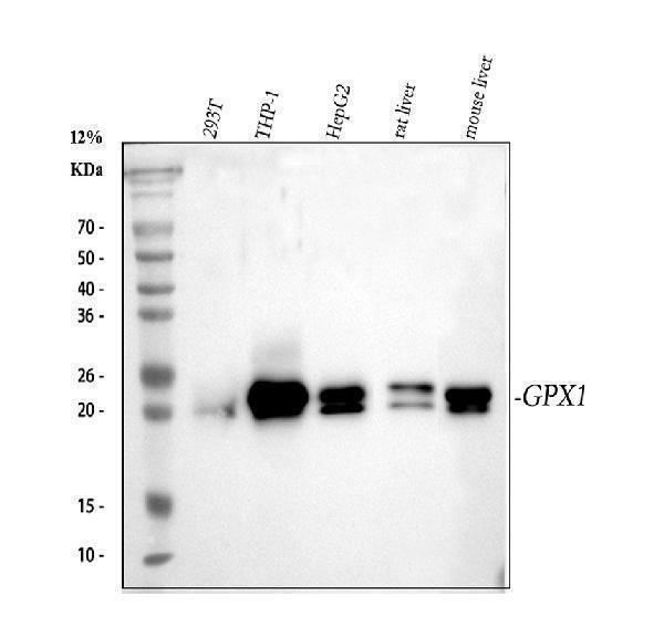  Western blot analysis of GPX1 using anti-GPX1 antibody (M01019-1)
