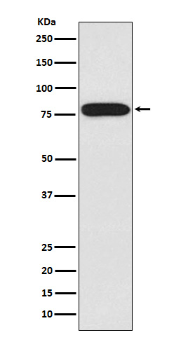 Western blot analysis of IRAK expression in HeLa cell lysate
