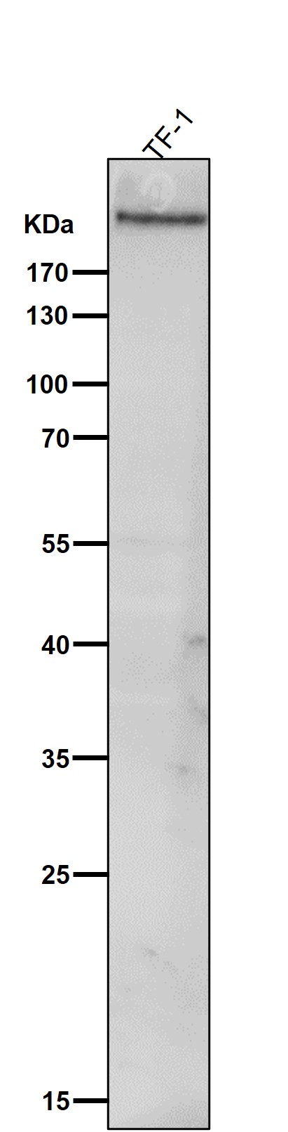 All lanes use the Antibody at 1:1K dilution for 1 hour at room temperature