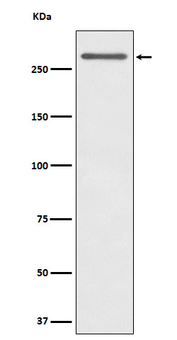 Western blot analysis of CD35 expression in Human tonsil cell lysate