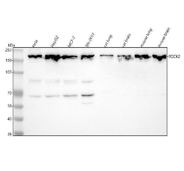  Western blot analysis of ROCK2 using anti-ROCK2 antibody (M01023)