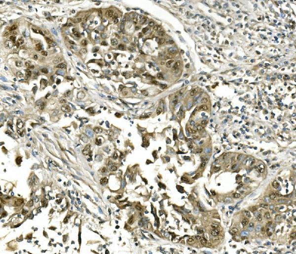  IHC analysis of Hsc70 using anti-Hsc70 antibody (M01024-1)