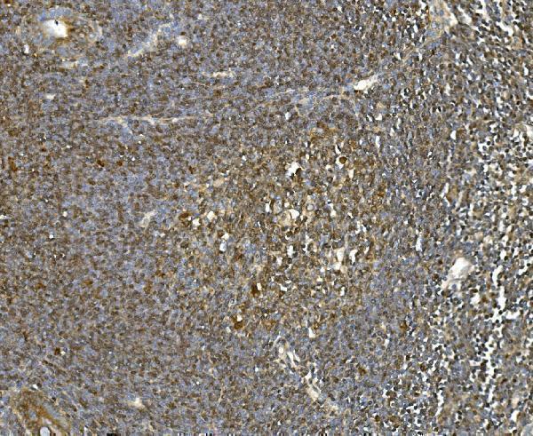 m01024 1 hsc70 primary antibodies ihc testing 5_1