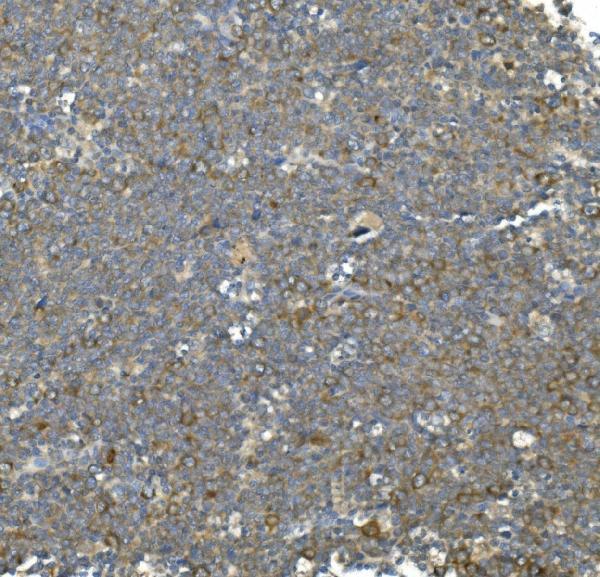 m01024 1 hsc70 primary antibodies ihc testing 6_1
