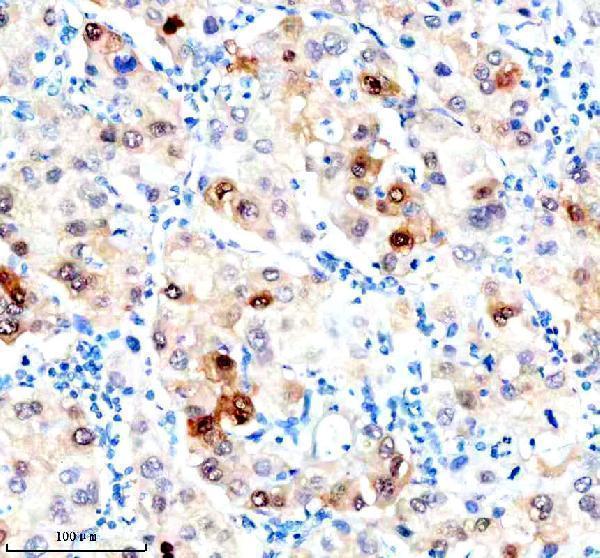 m01024 1 hsc70 primary antibodies ihc testing 8