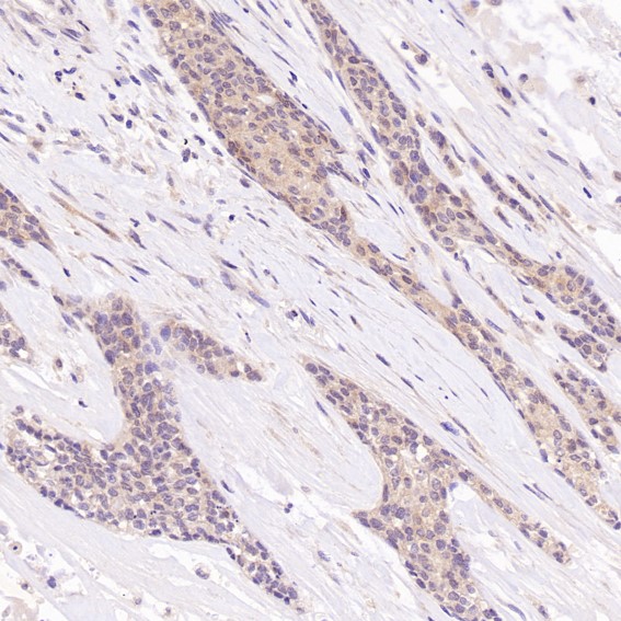 m01024 ihc10