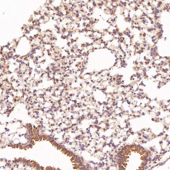 m01024 ihc11