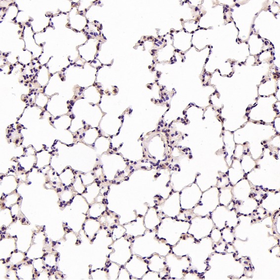 m01024 ihc7
