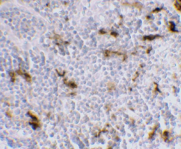 Immunohistochemistry of DC-SIGN in human lymph node tissue with DC-SIGN antibody at 5 μg/mL