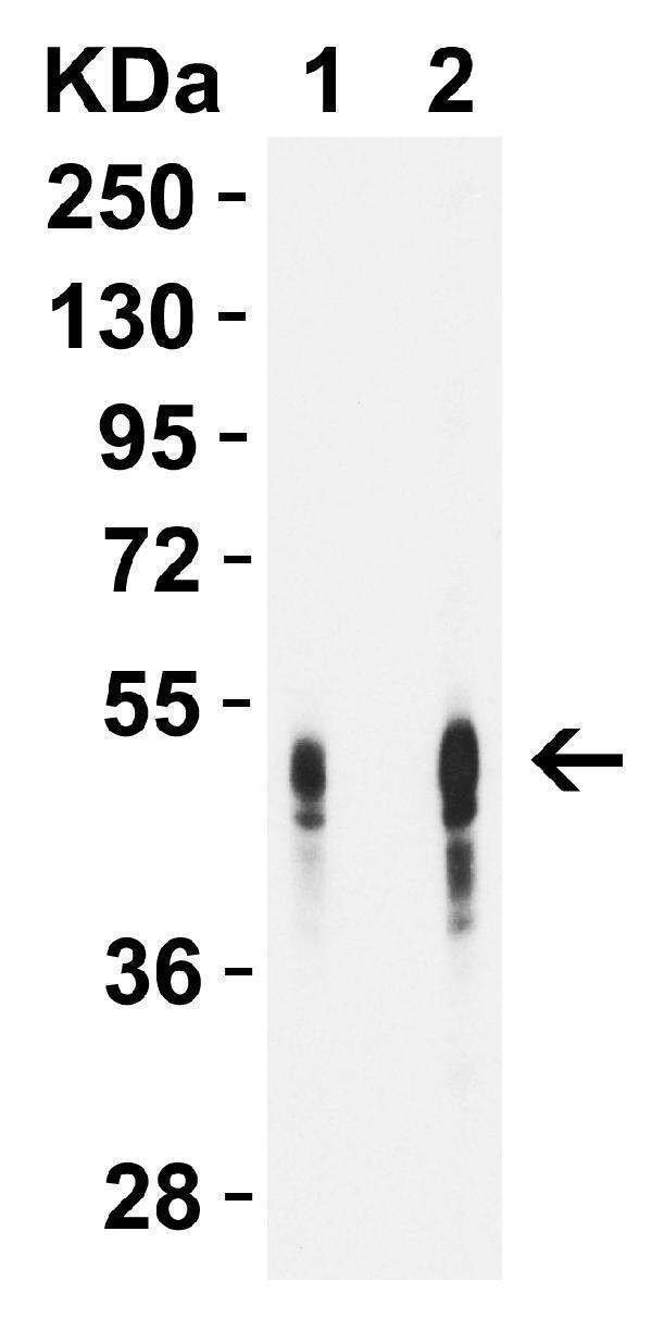   WB Validation of DC-SIGN in Human Lymph Node 
Loading: 10 μg of lysate per lane
