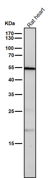 All lanes use the Antibody at 1:1K dilution for 1 hour at room temperature
