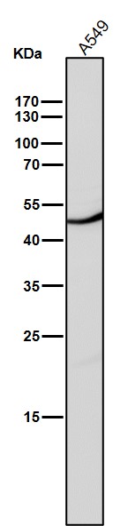 All lanes use the Antibody at 1:1K dilution for 1 hour at room temperature
