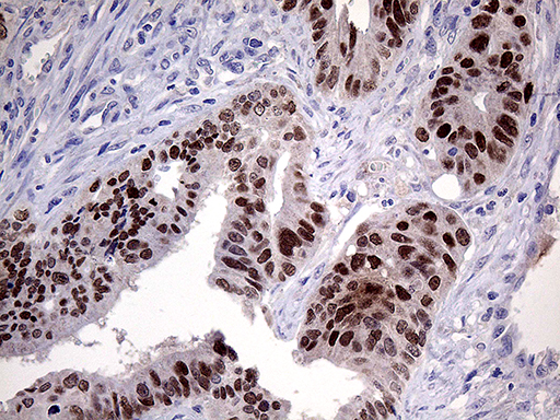 m01027 anti ese1 elf3 mouse monoclonal antibody clone id oti6g6 ihc testing 4