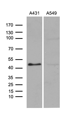 m01027 anti ese1 elf3 mouse monoclonal antibody clone id oti6g6 wb testing 2