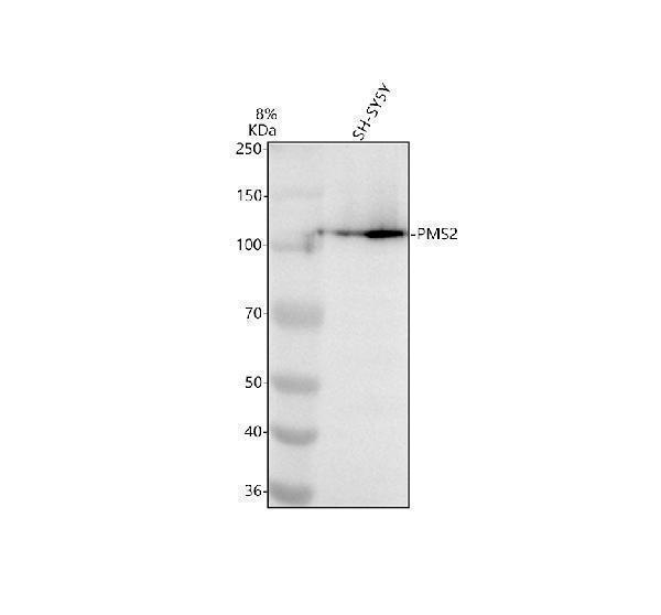 Western blot analysis of PMS2 using anti-PMS2 antibody (M01028-1)