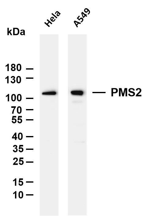 Various whole cell lysates were separated by 4-20% SDS-PAGE, and the membrane was blotted with anti-PMS2 antibody