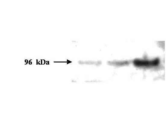 Western blot analysis is shown using Boster's Protein A Purified Mouse Monoclonal Anti-PMS2 antibody to detect human PMS2 protein present in H157 cell lysates