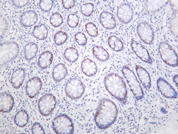 Human colon was stained with anti-Rpb1 rabbit antibody