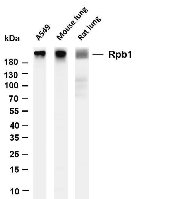 Various whole cell lysates were separated by 4-20% SDS-PAGE, and the membrane was blotted with anti-Rpb1 antibody