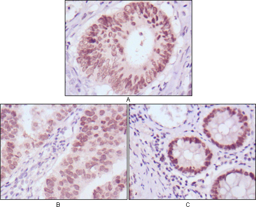 m01032 1 foxa2 primary antibodies ihc testing 1