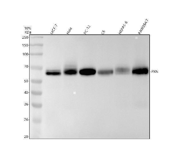 Western blot analysis of PXN using anti-PXN antibody (M01033)