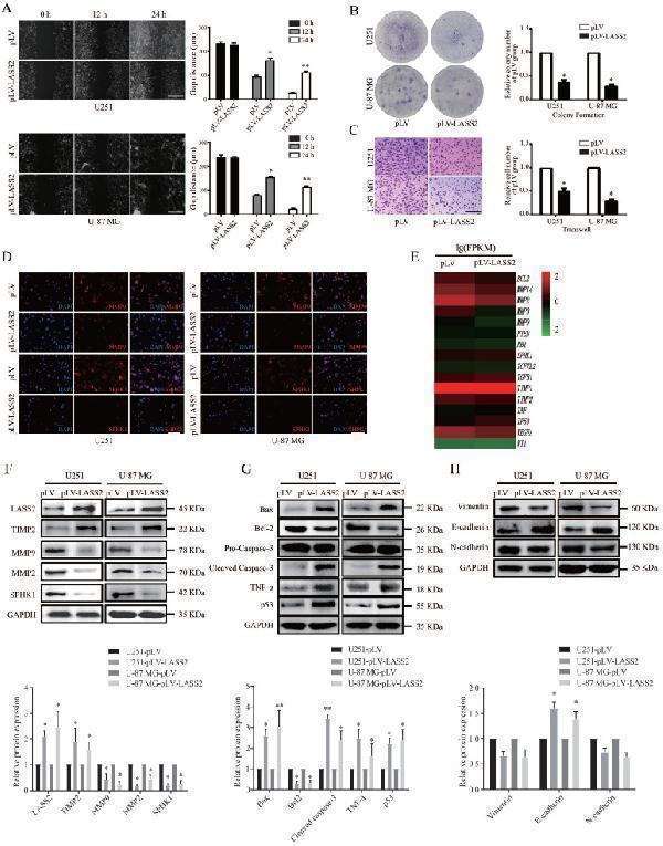 Effect of LASS2 on cell migration, invasion and apoptosis