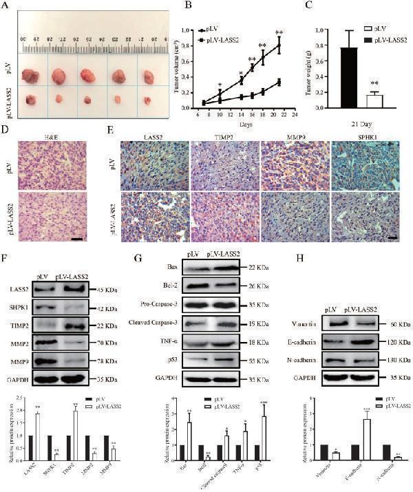 LASS2 inhibited tumor growth in a pLV-LASS2-U-87 MG glioblastoma xenograft nude mouse model