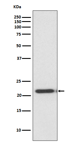 Western blot analysis of TIMP2 expression in HeLa cell lysate