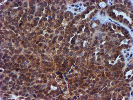 m01037 2 anti timp2 mouse monoclonal antibody clone id oti1a6 ihc testing 3