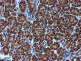m01037 2 anti timp2 mouse monoclonal antibody clone id oti1a6 ihc testing 4