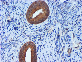 m01037 2 anti timp2 mouse monoclonal antibody clone id oti1a6 ihc testing 5