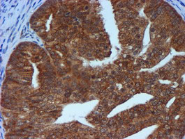 m01037 2 anti timp2 mouse monoclonal antibody clone id oti1a6 ihc testing 6
