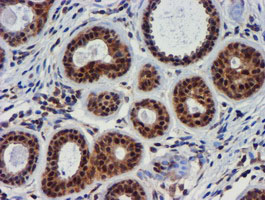 m01037 2 anti timp2 mouse monoclonal antibody clone id oti1a6 ihc testing 7