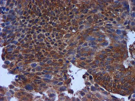 m01037 2 anti timp2 mouse monoclonal antibody clone id oti1a6 ihc testing 8