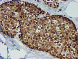 m01037 2 anti timp2 mouse monoclonal antibody clone id oti1a6 ihc testing 9