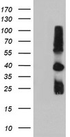 m01037 2 anti timp2 mouse monoclonal antibody clone id oti1a6 wb testing 1